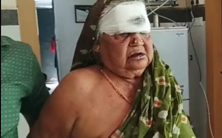 ପୁଅବୋହୂ ଙ୍କ ମାଡ଼ରେ ଲହୁଲୁହାଣ ହେଲା ମା "... ଗୁରୁତର ଅବସ୍ଥାରେ ଆସିକା ମେଡିକାଲରେ ଭର୍ତ୍ତି l